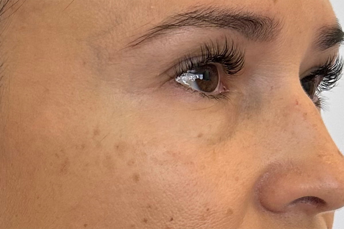 Lash Services Before & After Image
