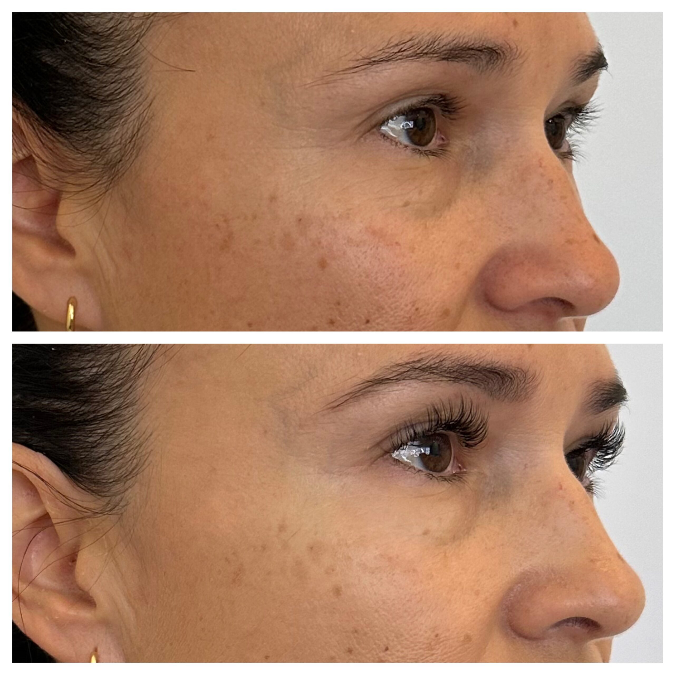Neurotoxin, VI Peel, Lash Extensions